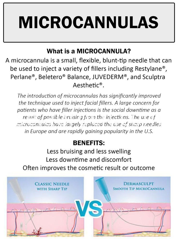 microcannulas microcannulas